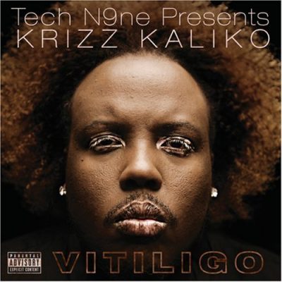 Krizz Kaliko - 2008 - Vitiligo